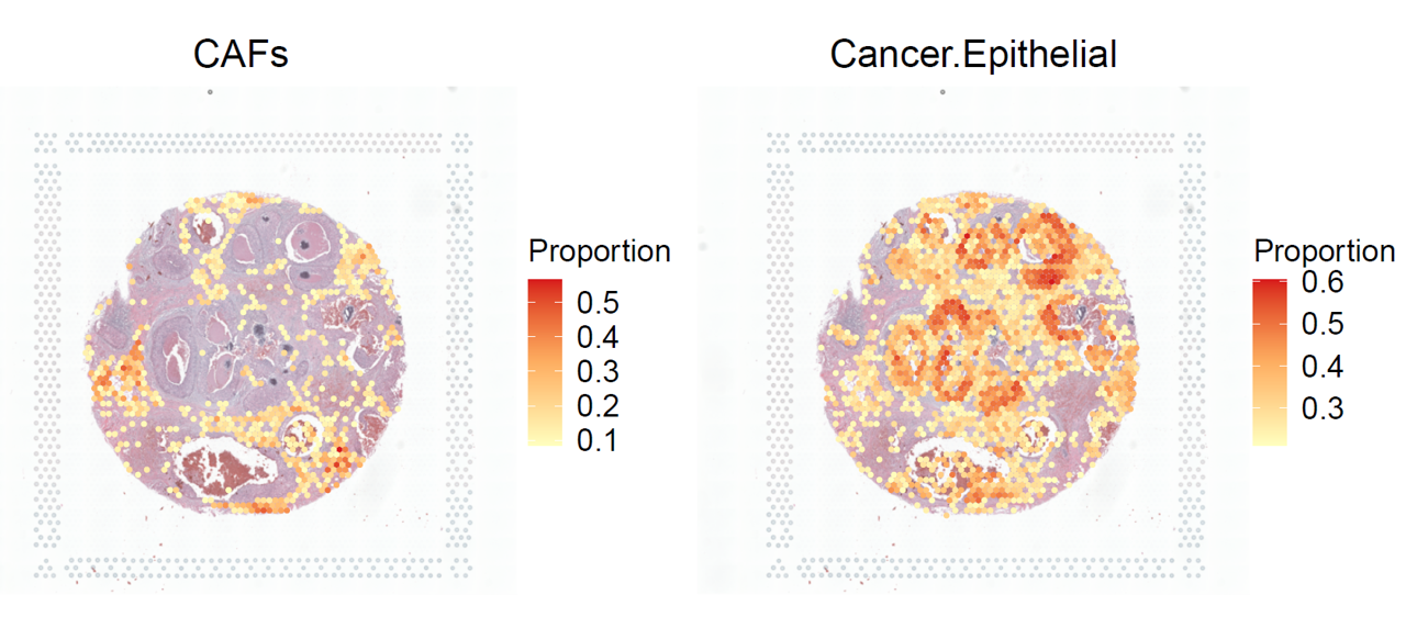 ../../_images/BRCA_CAFs_Cancer.Epithelial.png